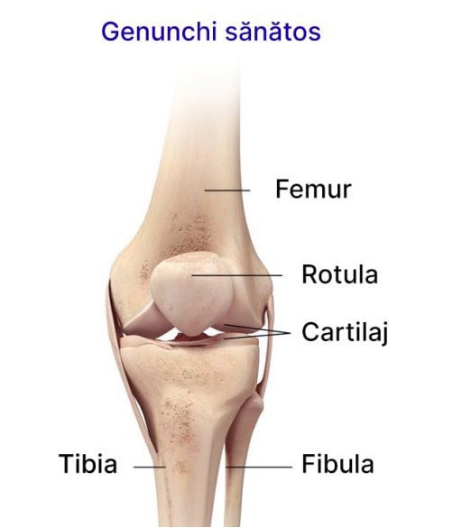 blocajul articulației genunchiului ce este